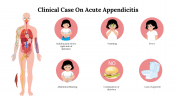 Creative Clinical Case On Acute Appendicitis Google Slides