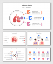 Easily Use Tuberculosis PPT And Google Slides Templates