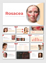 Easy To Customizable Rosacea PowerPoint And Google Slides