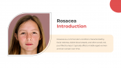 300832-Rosacea_02