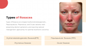 300832-Rosacea_05