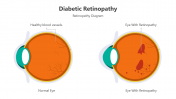 500838-Diabetic-Retinopathy_01