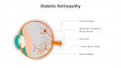 500838-Diabetic-Retinopathy_03