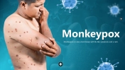 500878-Monkeypox-01