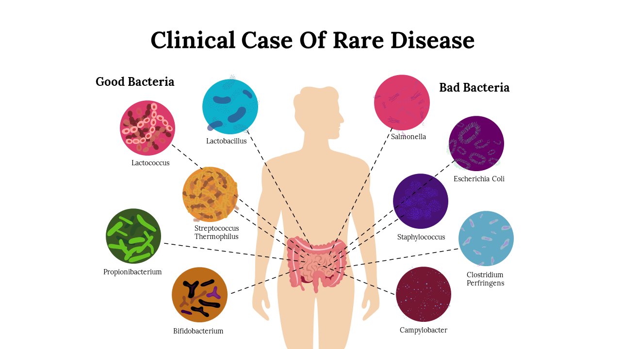 Clinical case of rare disease slide with illustrations of various bacteria linked to a human digestive system.