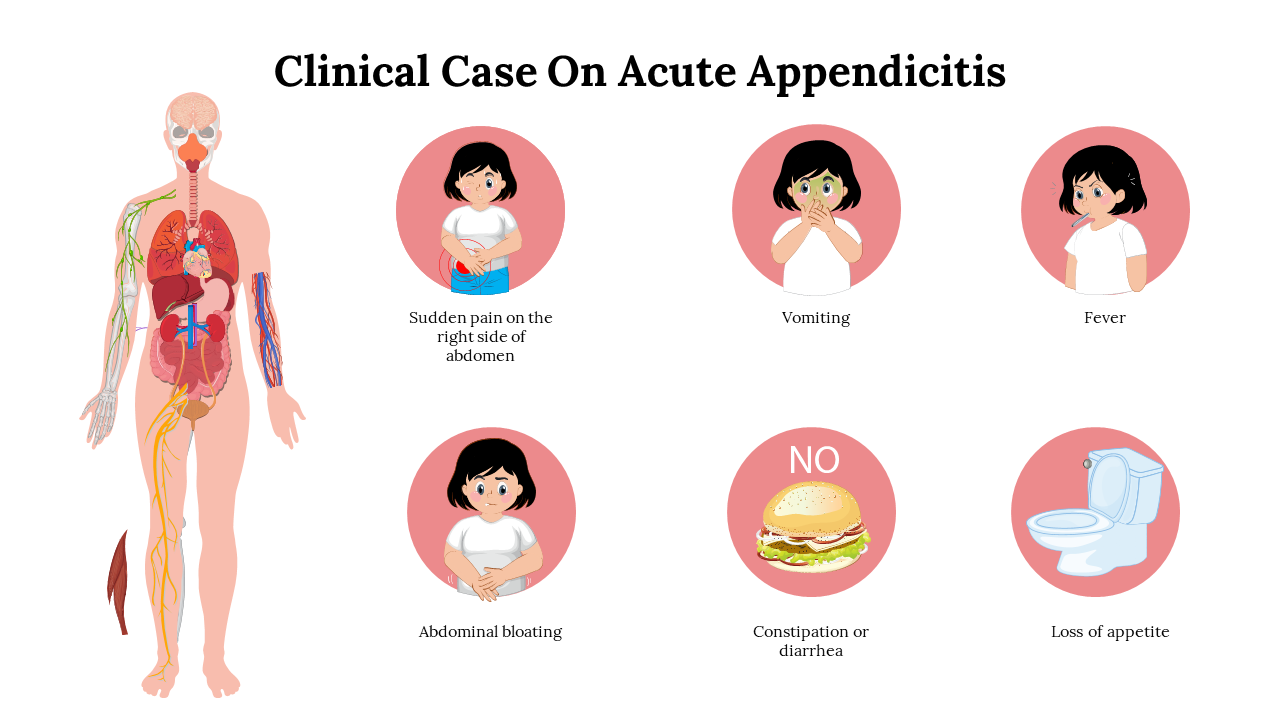 A clinical slide showing a human body outline and key symptoms of acute appendicitis in a child.