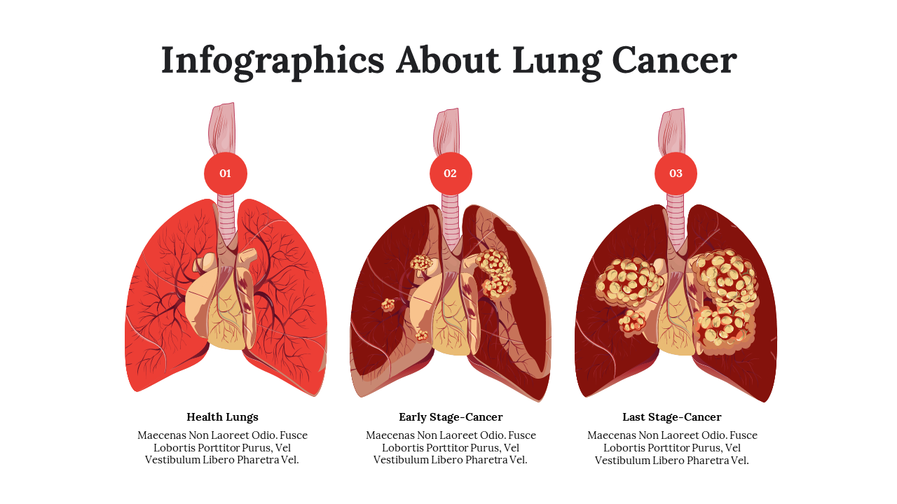 Stages of lung health, from healthy lungs to early-stage cancer and late-stage cancer, with illustrations of lung changes.