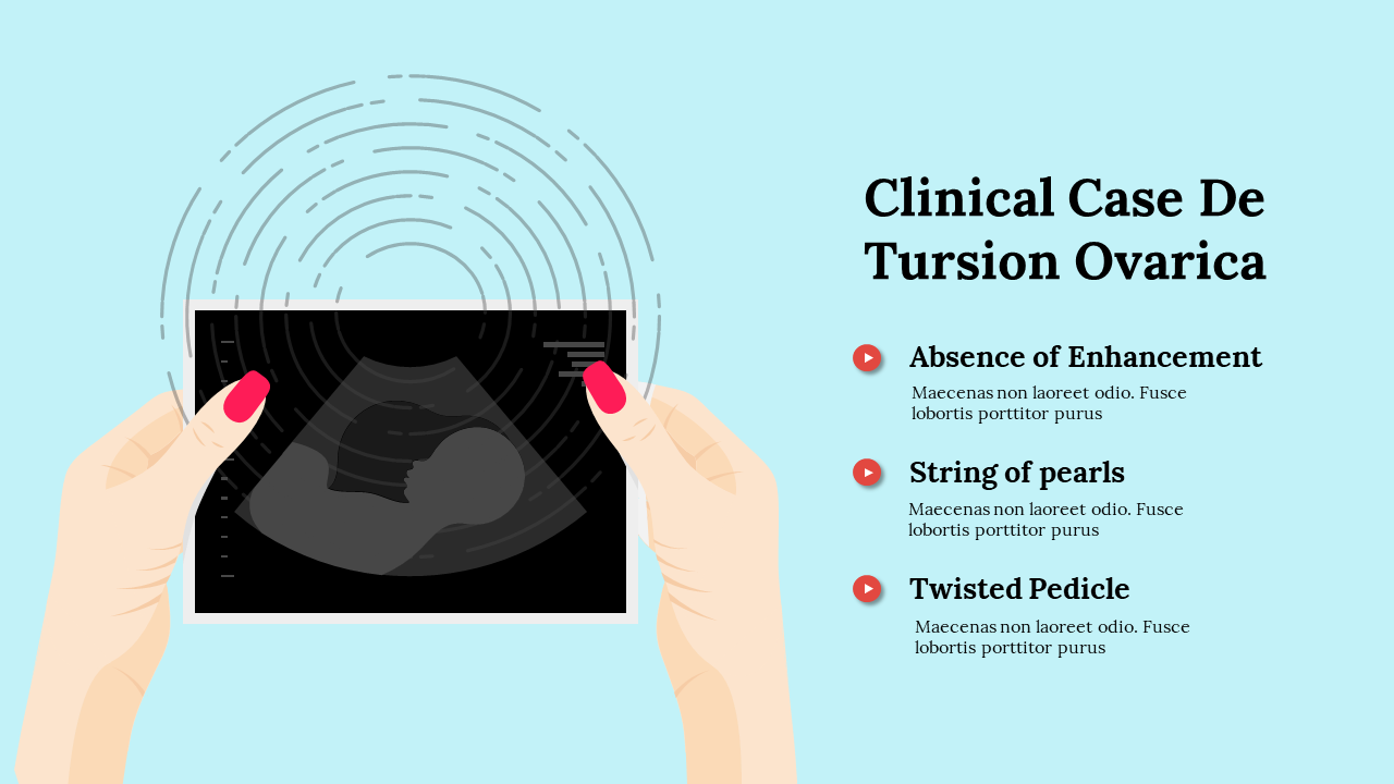 Clinical Case De Tursion Ovarica with an ultrasound image in the center and text detailing signs.