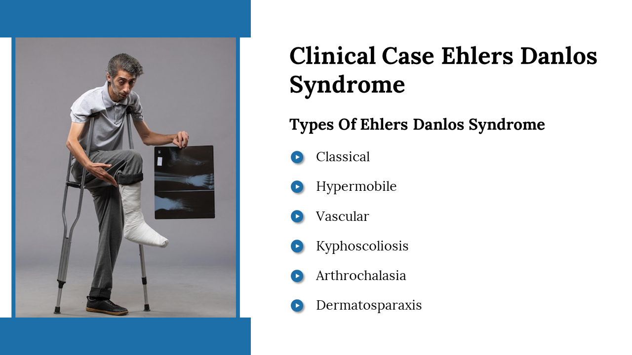 A man on crutches holding an X ray, illustrates a clinical case of Ehlers Danlos Syndrome with a list of its types.