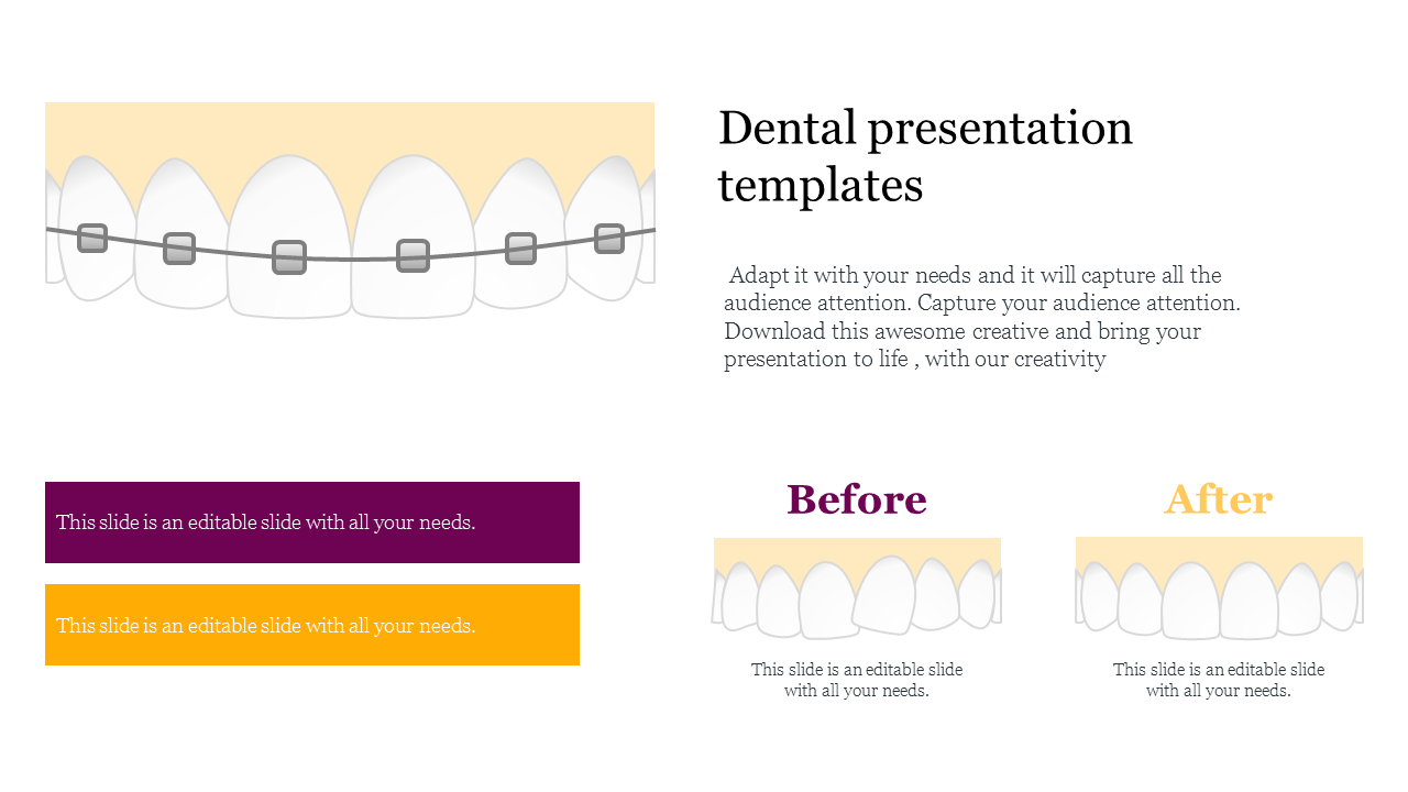 A dental slide displaying a graphic of teeth with braces, featuring text boxes and two sections.