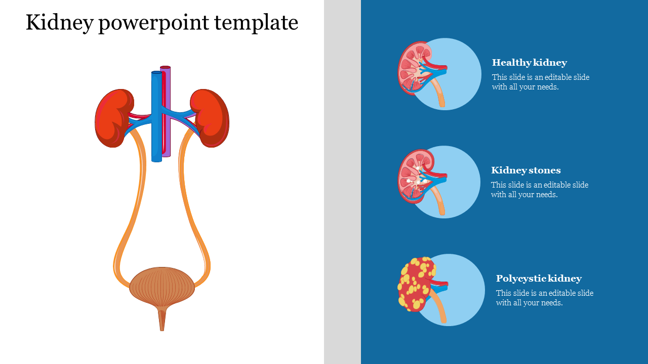 Slide illustrating kidney structure and different kidney conditions with placeholder text on a blue and white theme.