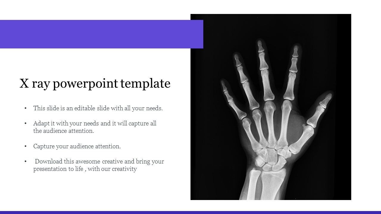 X-ray image of a hand on the right, with text listed on the left, bordered by purple bars.