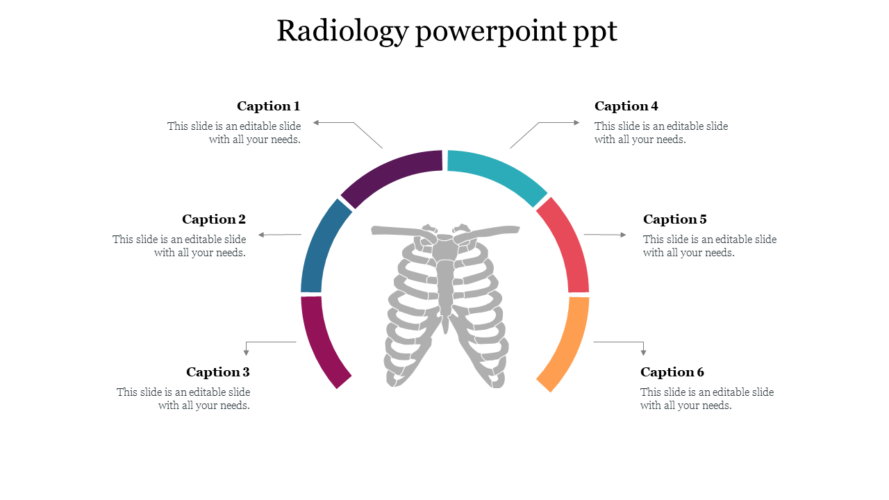 Radiology slide featuring a circular design with captions and a central image of ribcage anatomy.