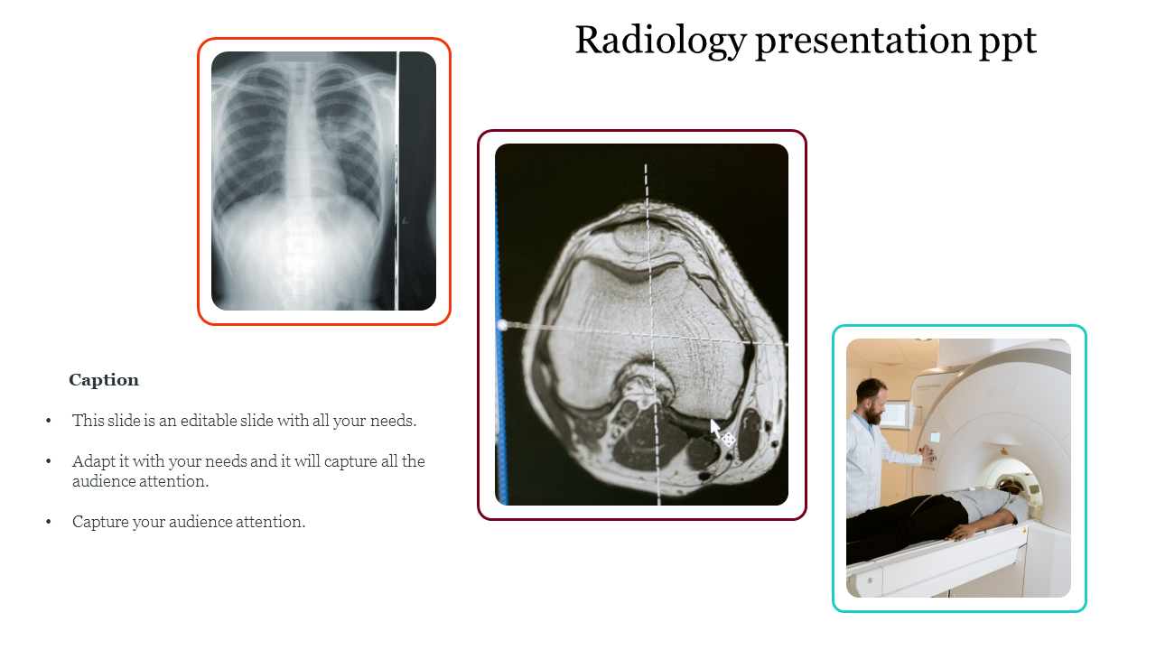 Three diagnostic images of an X ray, a CT scan, and a patient in an MRI machine with caption on a white background.