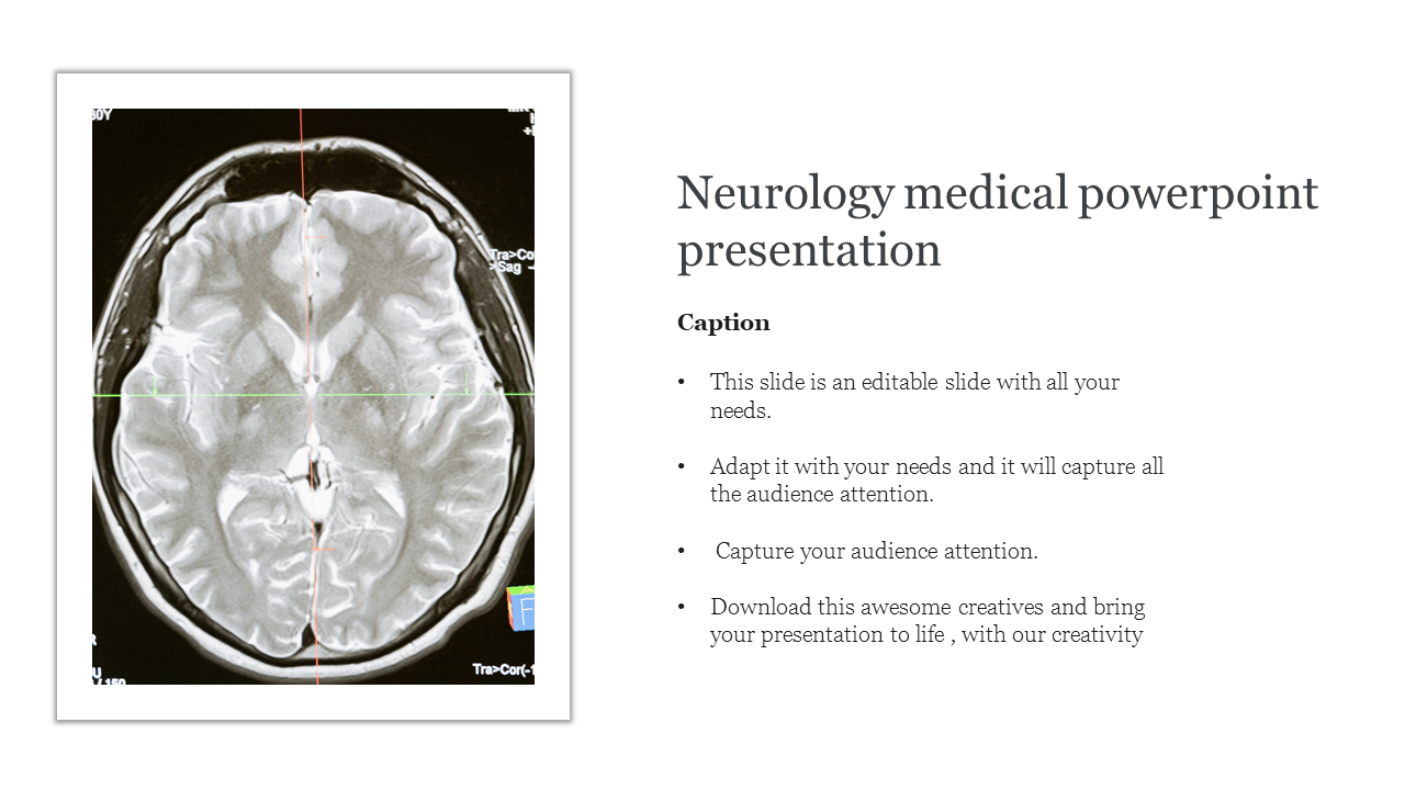 Slide from a neurology presentation showcasing a brain MRI, with spaces for captions and audience engagement prompts.