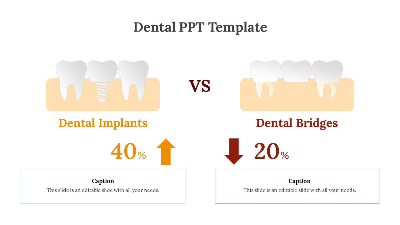 Comparison slide showing dental implants with an increase and dental bridges with a decrease in percentages and captions.