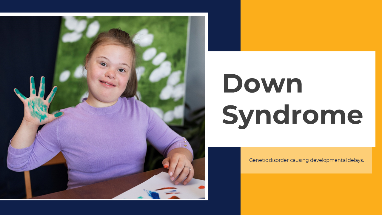 Down syndrome slides with yellow and navy layout, discussing screening, medical care, and educational support.