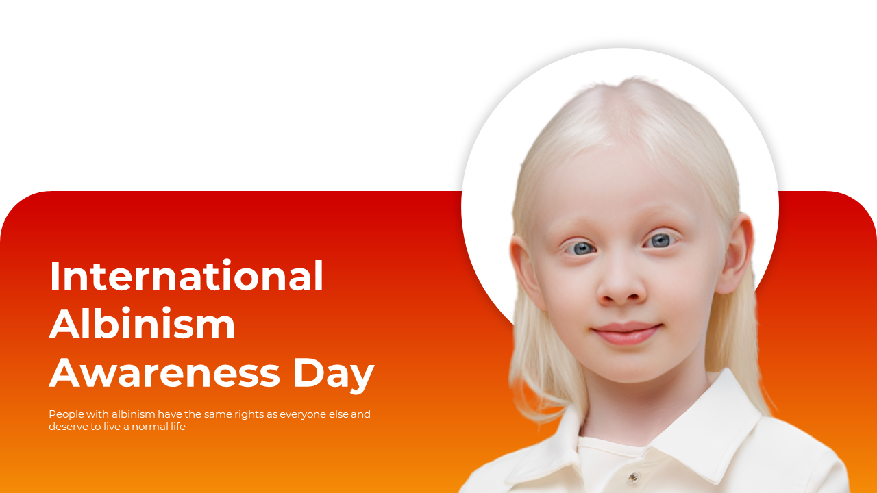 International Albinism Awareness day slides featuring informative slides on albinism, its history, and cultural perspectives.