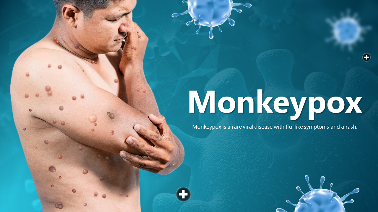 Informative Monkeypox PPT, Google Slides And Canva Templates