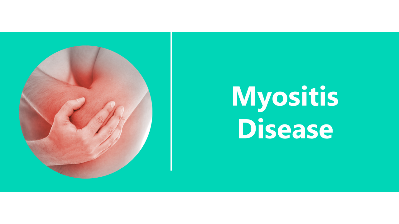 Usable Myositis Disease Presentation And Google Slides