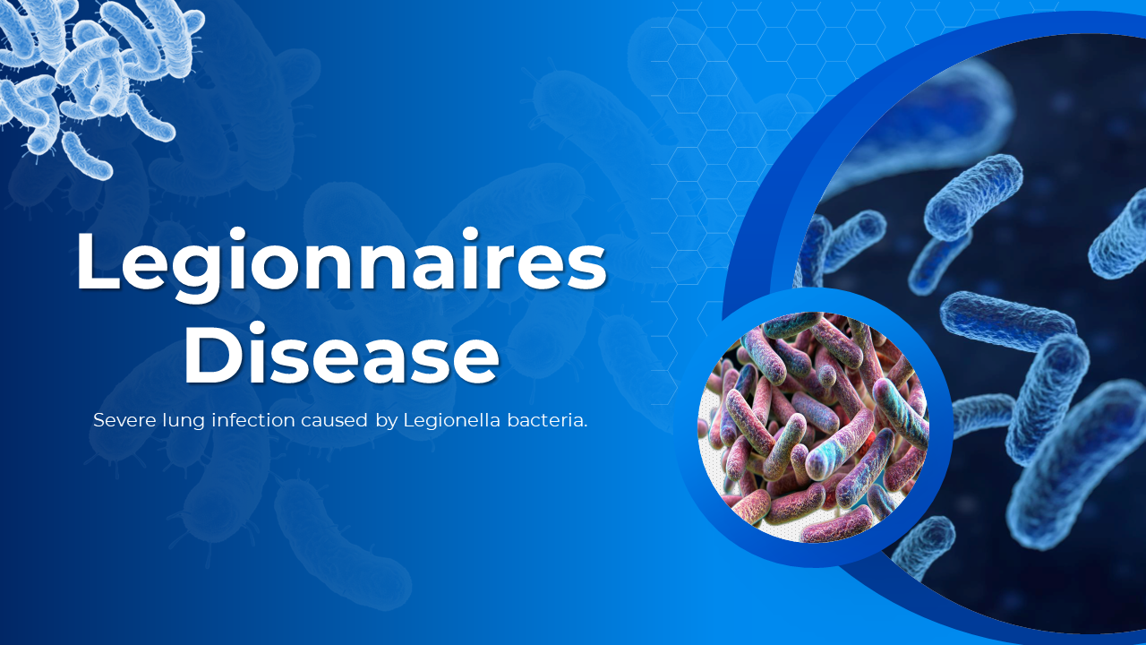 Legionnaires Disease Presentation And Google Slides Themes