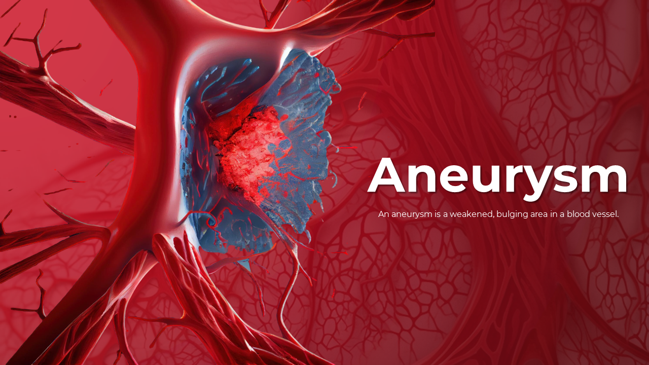 Aneurysm PowerPoint, Google Slides And Canva Templates