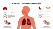 Clinical diagram slide showing the human respiratory system with lung infections and factors contributing to pneumonia.