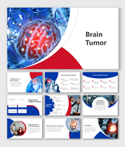 Editable Brain Tumor Presentation And Google Slides Themes