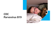 Editable CDC Parvovirus B19 PPT And Google Slides Template