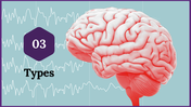 300057-international-epilepsy-day-21