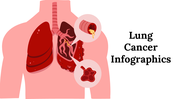 300125-lung-cancer-infographics-01