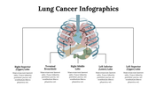 300125-lung-cancer-infographics-07-2