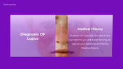 300374-world-lupus-day-presentation-06