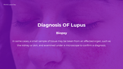 300374-world-lupus-day-presentation-09