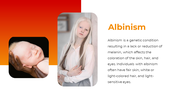 300396-international-albinism-awareness-day-04