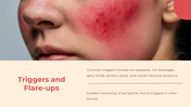 300832-rosacea-04