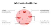 400350-infographics-on-allergies-10