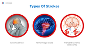 400577-world-stroke-day-06