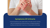 500299-urticaria-day-05