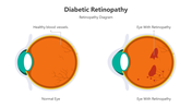 500838-diabetic-retinopathy-01