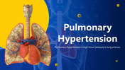 500885-pulmonary-hypertension-01