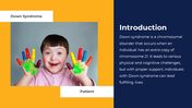 703567-down-syndrome-powerpoint-presentation-02