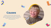 703571-down-syndrome-powerpoint-slides-10