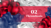 704815-world-thrombosis-disease-day-09