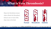 704815-world-thrombosis-disease-day-12