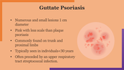 704848-world-psoriasis-day-21