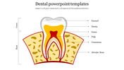 Dental cross-section showing the crown and root, labeled with layers such as enamel, dentin, gums, and more.