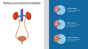 Slide illustrating kidney structure and different kidney conditions with placeholder text on a blue and white theme.