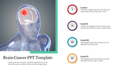 Human anatomy graphic showing a brain tumor in red, with a sidebar listing brain cancer stages in circular icons.